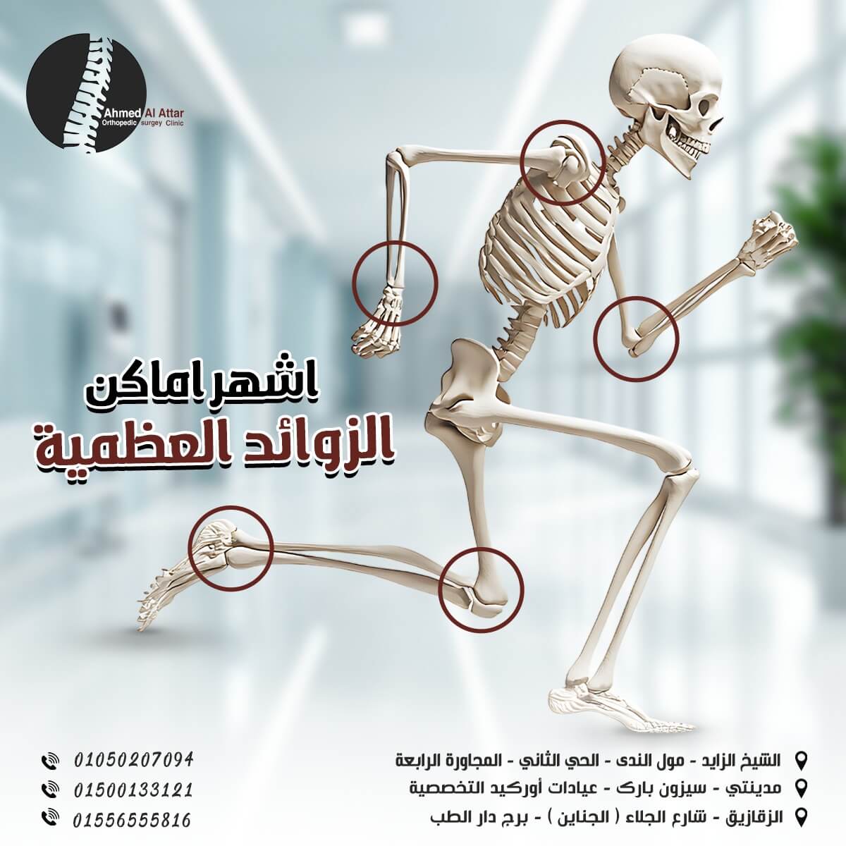 الزوائد العظمية – أسبابها، أعراضها، وعلاجها الفعّال بشكل نهائي!