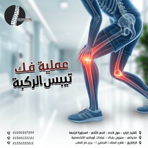عملية فك تيبس الركبة