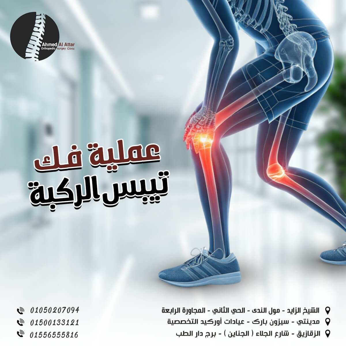 عملية فك تيبس الركبة الأسباب والإجراءات ونتائج العلاج!