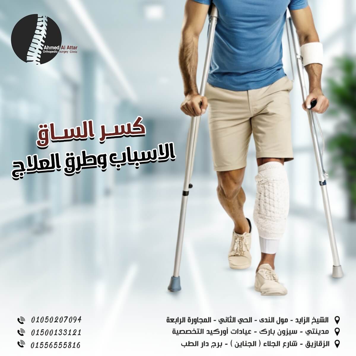 كسر الساق الاسباب وطرق العلاج مع الدكتور احمد العطار